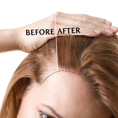 NORMADENSE Vegan Hair Oil for Normal to Thin - Looking Hair - SNOBGIRLS.com