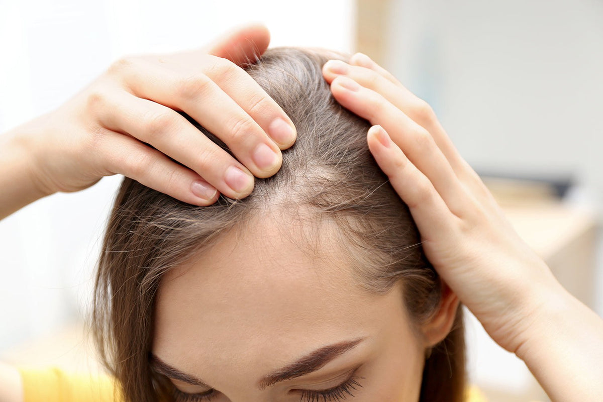 Close-up of woman with thinning hair showing scalp, promoting vegan shampoo conditioner for fuller denser hair