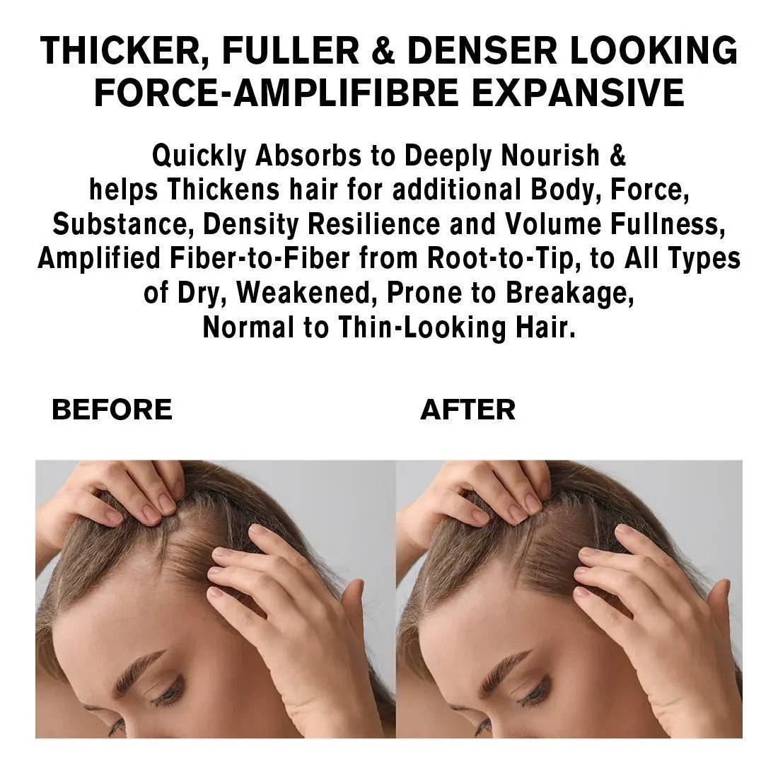 NORMADENSE Salon Vegan Hair Oil Thicker Fuller Denser for Normal to ThNORMADENSE Salon Vegan Hair Oil Thicker Fuller DenserSNOBGIRLS.com